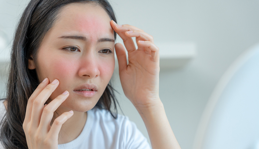 Skin Redness: Why Is My Skin So Blotchy?